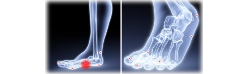 Inside Arch Pain
